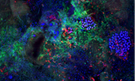 UFZ - imaging of biofilms